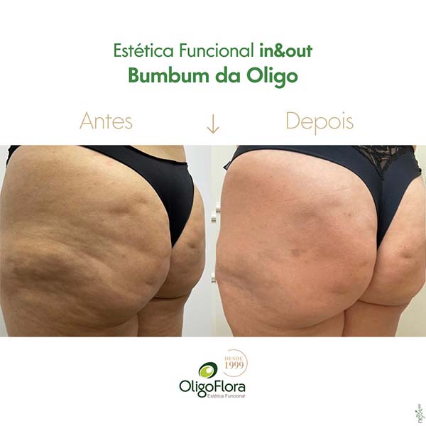 bumbum da oligo