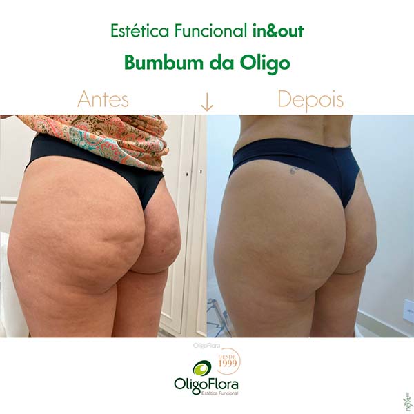 bumbum da oligo2