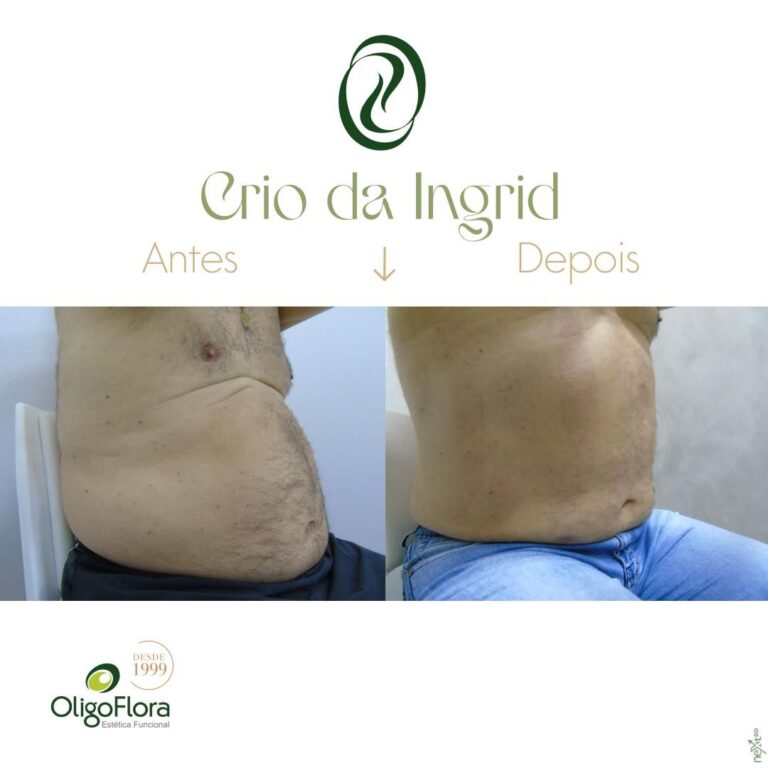crio da Ingrid-antes-edepois1
