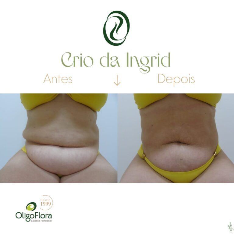 crio da Ingrid-antes-edepois2