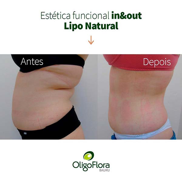 lipo sem cortes1